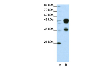FOXA1 Rabbit Polyclonal Antibody