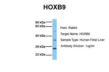 HOXB9 Rabbit Polyclonal Antibody