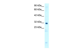 HOXB9 Rabbit Polyclonal Antibody