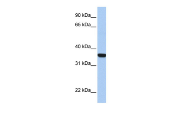HOXD1 Rabbit Polyclonal Antibody