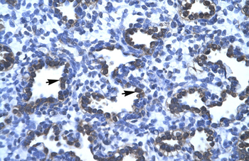 APEX1 Rabbit Polyclonal Antibody