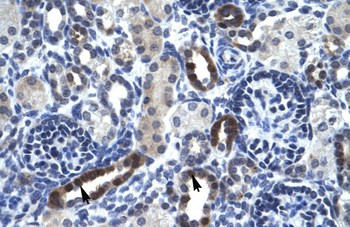 TSFM Rabbit Polyclonal Antibody