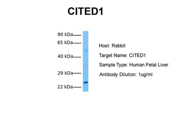 CITED1 Rabbit Polyclonal Antibody
