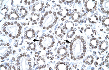CITED1 Rabbit Polyclonal Antibody