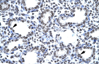 CITED1 Rabbit Polyclonal Antibody