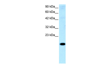 CITED1 Rabbit Polyclonal Antibody