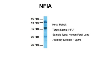 NFIA Rabbit Polyclonal Antibody