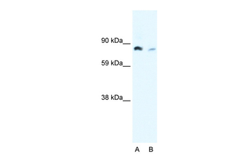 NFKB2 Rabbit Polyclonal Antibody