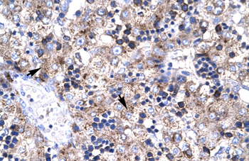 PAWR Rabbit Polyclonal Antibody