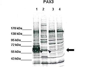 PAX3 Rabbit Polyclonal Antibody