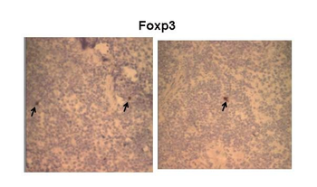 FOXP3 Rabbit Polyclonal Antibody