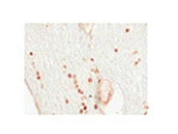 OLIG2 Rabbit Polyclonal Antibody
