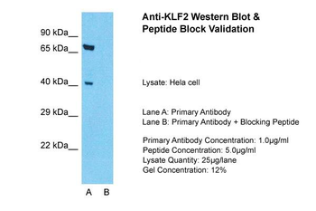 KLF2 Rabbit Polyclonal Antibody