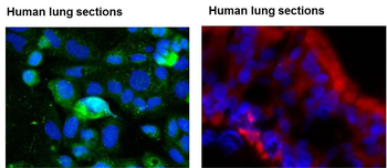KLF2 Rabbit Polyclonal Antibody