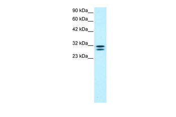 HTATIP2 Rabbit Polyclonal Antibody