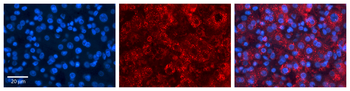 ACSL1 Rabbit Polyclonal Antibody