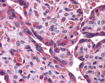 ACSL1 Rabbit Polyclonal Antibody