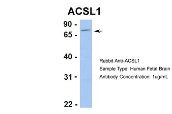 ACSL1 Rabbit Polyclonal Antibody