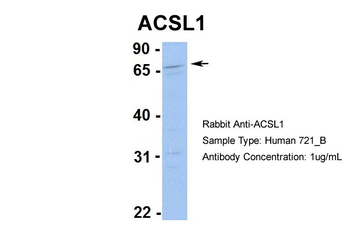 ACSL1 Rabbit Polyclonal Antibody