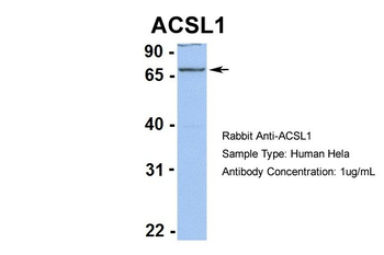 ACSL1 Rabbit Polyclonal Antibody