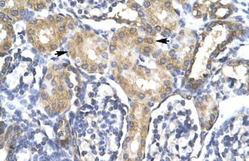 ACSL1 Rabbit Polyclonal Antibody