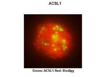 ACSL1 Rabbit Polyclonal Antibody