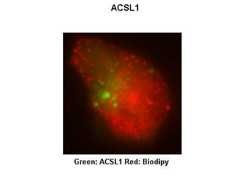 ACSL1 Rabbit Polyclonal Antibody