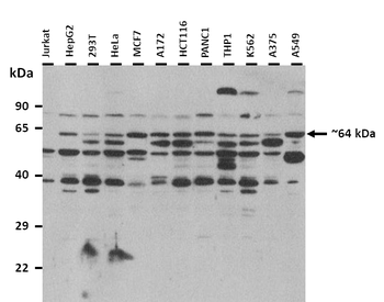 ME1 Rabbit Polyclonal Antibody
