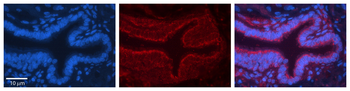 ME1 Rabbit Polyclonal Antibody