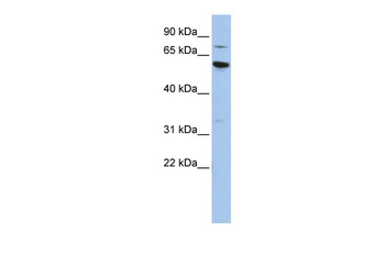 ME1 Rabbit Polyclonal Antibody