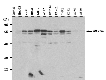 PCK1 Rabbit Polyclonal Antibody