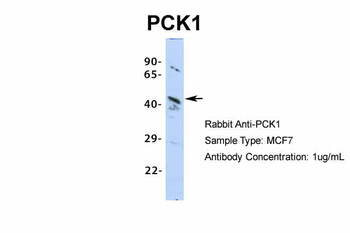 PCK1 Rabbit Polyclonal Antibody
