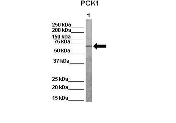 PCK1 Rabbit Polyclonal Antibody