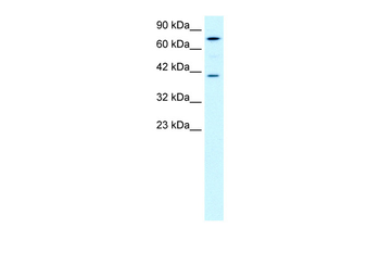 PCK1 Rabbit Polyclonal Antibody