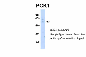 PCK1 Rabbit Polyclonal Antibody