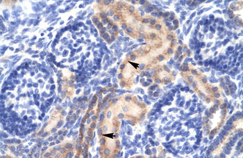 PCK1 Rabbit Polyclonal Antibody