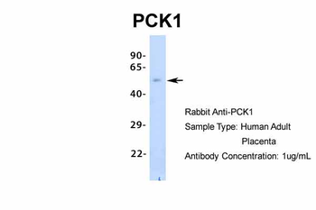 PCK1 Rabbit Polyclonal Antibody