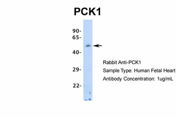 PCK1 Rabbit Polyclonal Antibody