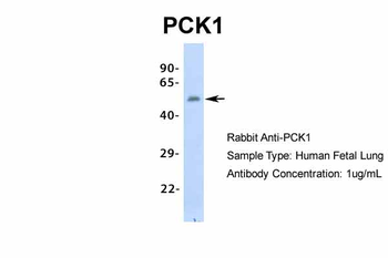 PCK1 Rabbit Polyclonal Antibody