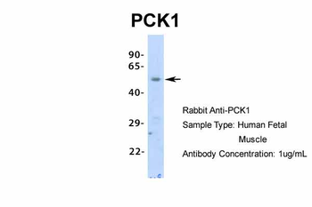 PCK1 Rabbit Polyclonal Antibody
