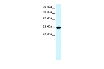 AQP7 Rabbit Polyclonal Antibody