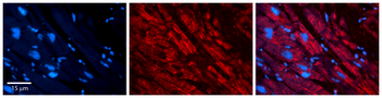 DBI Rabbit Polyclonal Antibody