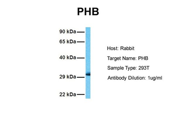 PHB Rabbit Polyclonal Antibody