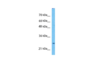 PHB Rabbit Polyclonal Antibody