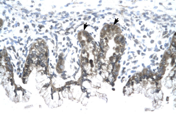 PHB Rabbit Polyclonal Antibody