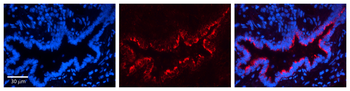PHB Rabbit Polyclonal Antibody