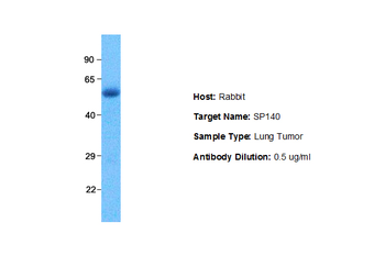 SP140 Rabbit Polyclonal Antibody