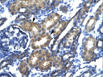 SP140 Rabbit Polyclonal Antibody