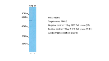 PPARG Rabbit Polyclonal Antibody