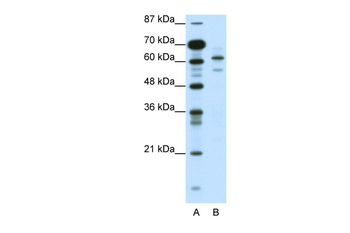 ZSCAN2 Rabbit Polyclonal Antibody